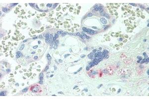 Detection of ICAM4 in Human Placenta Tissue using Polyclonal Antibody to Intercellular Adhesion Molecule 4 (ICAM4) (ICAM4 anticorps  (AA 23-227))