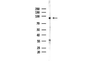 anti-Exosome Component 10 (EXOSC10) (Internal Region) antibody