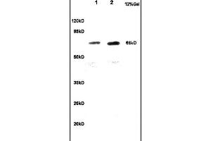 Lane 1: rat brain lysates Lane 2: mouse embryo lysates probed with Anti CKAP4 Polyclonal Antibody, Unconjugated  at 1:200 in 4˚C. (CKAP4 anticorps  (AA 525-602))