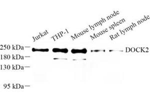 Western blot analysis of DOCK2 (ABIN7073706) at dilution of 1: 500 (DOCK2 anticorps)