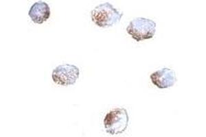 Immunocytochemistry of GNPDA2 in 293 cells with AP30369PU-N GNPDA2 antibody at 4 μg/ml.