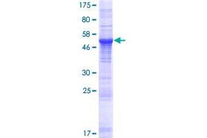 Image no. 1 for Regulatory Factor X-Associated Ankyrin Containing Protein (RFXANK) (AA 1-237) protein (GST tag) (ABIN1317893)