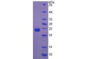 SDS-PAGE (SDS) image for Calreticulin (CALR) (AA 18-193) protein (His tag) (ABIN1169989)