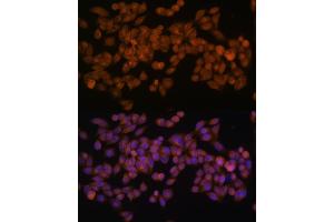 Immunofluorescence analysis of HeLa cells using Fatty Acid Synthase (FASN) Rabbit mAb  at dilution of 1:100 (40x lens).