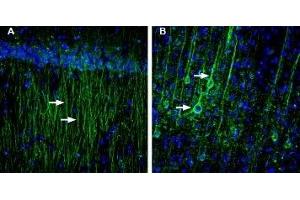 Expression of creatine transporter in rat hippocampus and cortex - Immunohistochemical staining of perfusion-fixed frozen rat brain sections with Anti-SLC6A8 Antibody (ABIN7043739, ABIN7044471 and ABIN7044472), (1:200), followed by goat anti-rabbit-AlexaFluor-488.