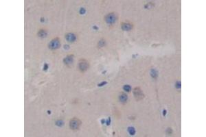 Used in DAB staining on fromalin fixed paraffin- embedded brain tissue (Glutaminase anticorps  (AA 31-253))