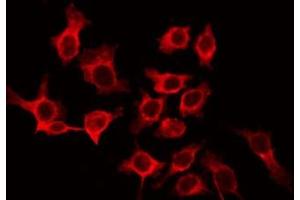 ABIN6266513 staining LOVO by IF/ICC. (CLDN10 anticorps  (C-Term))