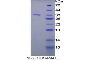 SDS-PAGE analysis of Mouse LOX1 Protein. (OLR1 Protéine)