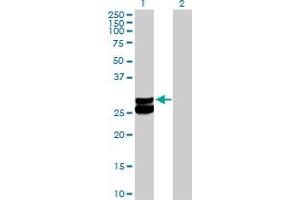 Western Blot analysis of ECHS1 expression in transfected 293T cell line by ECHS1 MaxPab polyclonal antibody. (ECHS1 anticorps  (AA 1-290))