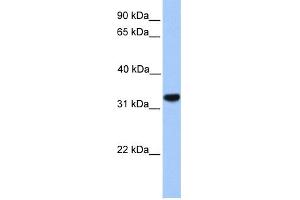 WB Suggested Anti-CACNG4 Antibody Titration:  0. (CACNG4 anticorps  (N-Term))