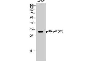 Western Blotting (WB) image for anti-Replication Protein A2, 32kDa (RPA2) (pSer33) antibody (ABIN3173126) (RPA2 anticorps  (pSer33))