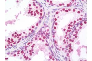 Anti-SSB / La antibody IHC staining of human prostate. (SSB anticorps)