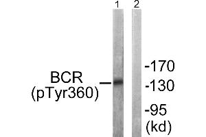 Immunohistochemistry analysis of paraffin-embedded human brain tissue using Bcr (Phospho-Tyr360) antibody. (BCR anticorps  (pTyr360))