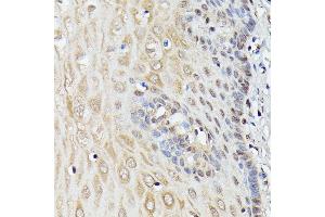 Immunohistochemistry of paraffin-embedded human esophageal using TRIP4 antibody (ABIN7270824) at dilution of 1:100 (40x lens).
