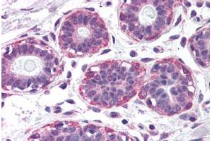 Human Breast (formalin-fixed, paraffin-embedded) stained with NET1 antibody ABIN299308 at 2. (NET1 anticorps  (AA 396-409))