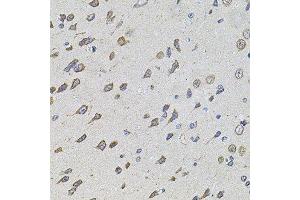Immunohistochemistry of paraffin-embedded rat brain using FOXO3 antibody.