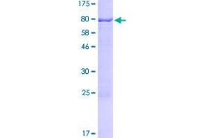 Image no. 1 for Nuclear Receptor Subfamily 6, Group A, Member 1 (NR6A1) (AA 1-475) protein (GST tag) (ABIN1312993)