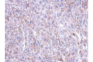 IHC-P Image Immunohistochemical analysis of paraffin-embedded HeLa xenograft, using CRFR1, antibody at 1:500 dilution.