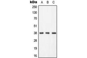Western blot analysis of LAT (pY255) expression in HEK293T (A), Raw264. (LAT anticorps  (C-Term, pTyr255))