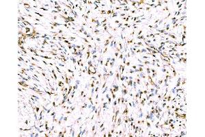 IHC analysis of Giantin/GOLGB1 using anti-Giantin/GOLGB1 antibody (ABIN7600139). (Golgin B1 (GOLGB1) (AA 153-950) anticorps)