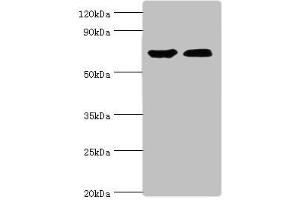 Western blot All lanes: CROT antibody at 3 μg/mL Lane 1: Mouse kidney tissue Lane 2: A431 whole cell lysate Secondary Goat polyclonal to rabbit IgG at 1/10000 dilution Predicted band size: 71, 11, 74 kDa Observed band size: 71 kDa