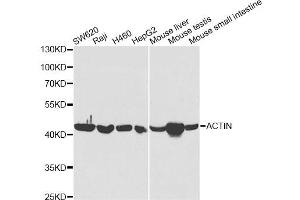 Western blot analysis of extracts of various cell lines, using ACAT1 antibody. (ACAT1 anticorps)