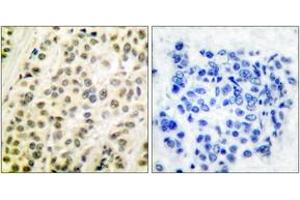 Immunohistochemistry (IHC) image for anti-Transcription Factor Dp-1 (TFDP1) (AA 361-410) antibody (ABIN2889186) (DP1 anticorps  (AA 361-410))