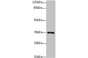 Western blot All lanes: MED27 antibody at 0. (MED27 anticorps  (AA 39-108))