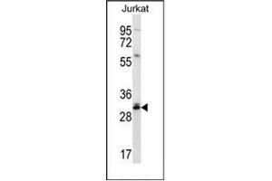 Western blot analysis of DULLARD Antibody  in Jurkat cell line lysates (35ug/lane). (CTDNEP1A anticorps  (Middle Region))