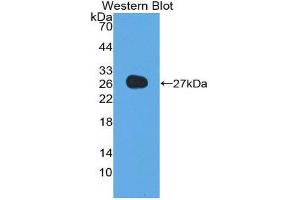 Western Blotting (WB) image for anti-Adiponectin (ADIPOQ) (AA 32-244) antibody (ABIN1857925) (ADIPOQ anticorps  (AA 32-244))