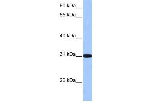 WB Suggested Anti-RFPL2 Antibody Titration: 0. (RFPL2 anticorps  (C-Term))
