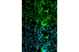 Immunofluorescence analysis of A549 cells using EPHA1 antibody (ABIN6290349). (EPHA1 anticorps)
