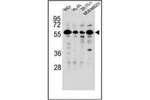 Western blot analysis of FOXC2 Antibody  in WiDr,HL-60,ZR-75-1,MDA-MB231 cell line lysates (35ug/lane). (FOXC2 anticorps  (Middle Region))