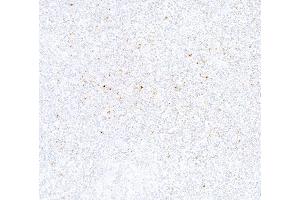 Immunohistochemistry (IHC) image for anti-Cytotoxic T-Lymphocyte-Associated Protein 4 (CTLA4) (C-Term) antibody (ABIN7795650)