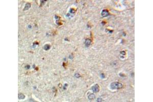 Used in DAB staining on fromalin fixed paraffin-embedded Brain tissue (SCG2 anticorps  (AA 11-187))