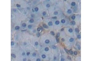 IHC-P analysis of Human Tissue, with DAB staining. (HLA-E anticorps  (AA 136-350))