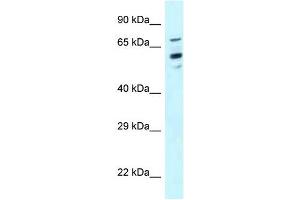 Western Blot showing TOMM70A antibody used at a concentration of 1 ug/ml against Hela Cell Lysate (TOM70 anticorps  (N-Term))