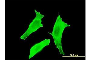 Immunofluorescence of monoclonal antibody to BTLA on HeLa cell.