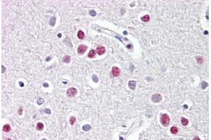 Image no. 2 for anti-Nuclear Receptor Subfamily 1, Group D, Member 1 (NR1D1) (AA 290-339) antibody (ABIN6749732)