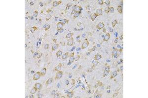 Immunohistochemistry of paraffin-embedded rat brain using IL10RA Antibody (ABIN5970931) at dilution of 1/100 (40x lens). (IL-10RA anticorps)