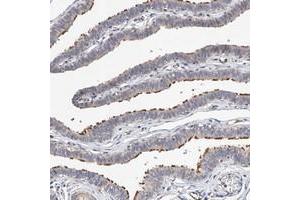 Immunohistochemical staining of human fallopian tube with LACE1 polyclonal antibody  shows strong positivity in ciliated cells. (LACE1 anticorps)