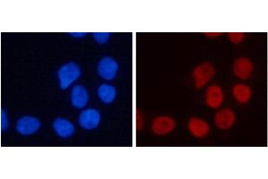 Immunofluorescence analysis of 293T cells using TriMethyl-Histone H3-K4 Polyclonal Antibody (Histone 3 anticorps  (3meLys4))