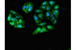 Immunofluorescent analysis of HepG2 cells using ABIN7153418 at dilution of 1:100 and Alexa Fluor 488-congugated AffiniPure Goat Anti-Rabbit IgG(H+L)
