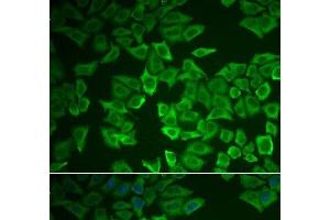 Immunofluorescence analysis of HeLa cells using CRHBP Polyclonal Antibody