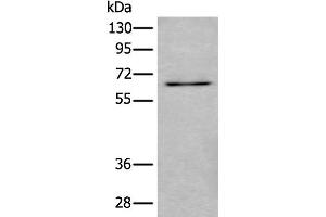 Western blot analysis of SKOV3 cell lysate using UBQLN2 Polyclonal Antibody at dilution of 1:500 (Ubiquilin 2 anticorps)