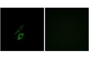 Immunofluorescence analysis of A549 cells, using FPR1 Antibody. (FPR1 anticorps  (AA 151-200))