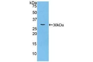 Detection of Recombinant CA125, Mouse using Polyclonal Antibody to Carbohydrate Antigen 125 (CA125) (MUC16 anticorps  (AA 2-258))