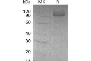 Western Blotting (WB) image for Scavenger Receptor Class B, Member 2 (SCARB2) protein (His tag) (ABIN7320638)