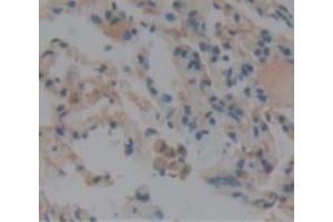 Used in DAB staining on fromalin fixed paraffin- embedded lung tissue (CNN2 anticorps  (AA 1-269))