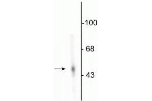 Western blot of rat adrenal medulla showing specific immunolabeling of the ~55 kDa DDC protein. (DDC anticorps)